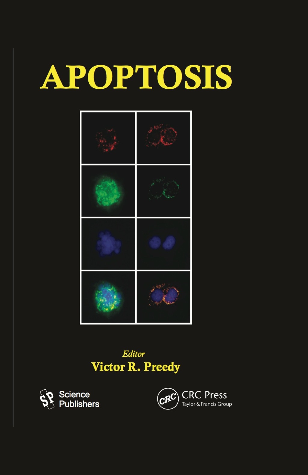 Apoptosis Modern Insights into Disease from Molecules to Man 1st Edition â€“ PDF/EPUB Version Downloadable