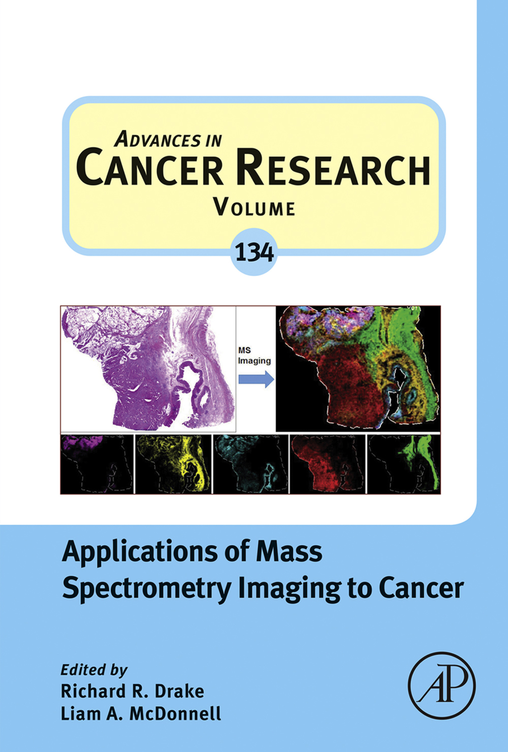 Applications of Mass Spectrometry Imaging to Cancer â€“ PDF/EPUB ...