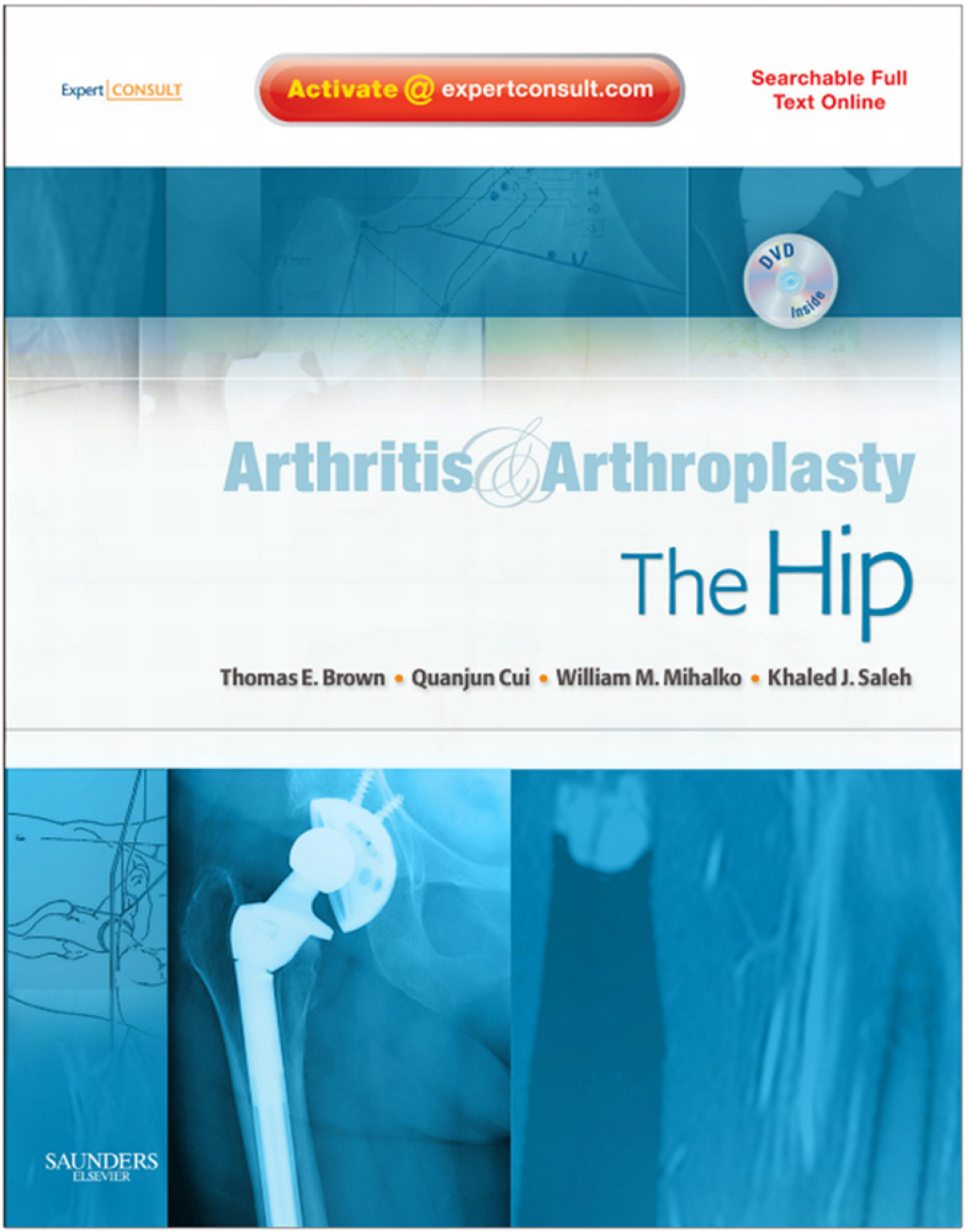 Arthritis and Arthroplasty: The Hip â€“ PDF/EPUB Version Downloadable