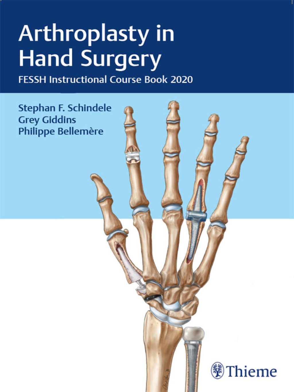 Arthroplasty in Hand Surgery FESSH Instructional Course Book 2020 1st Edition â€“ PDF/EPUB Version Downloadable