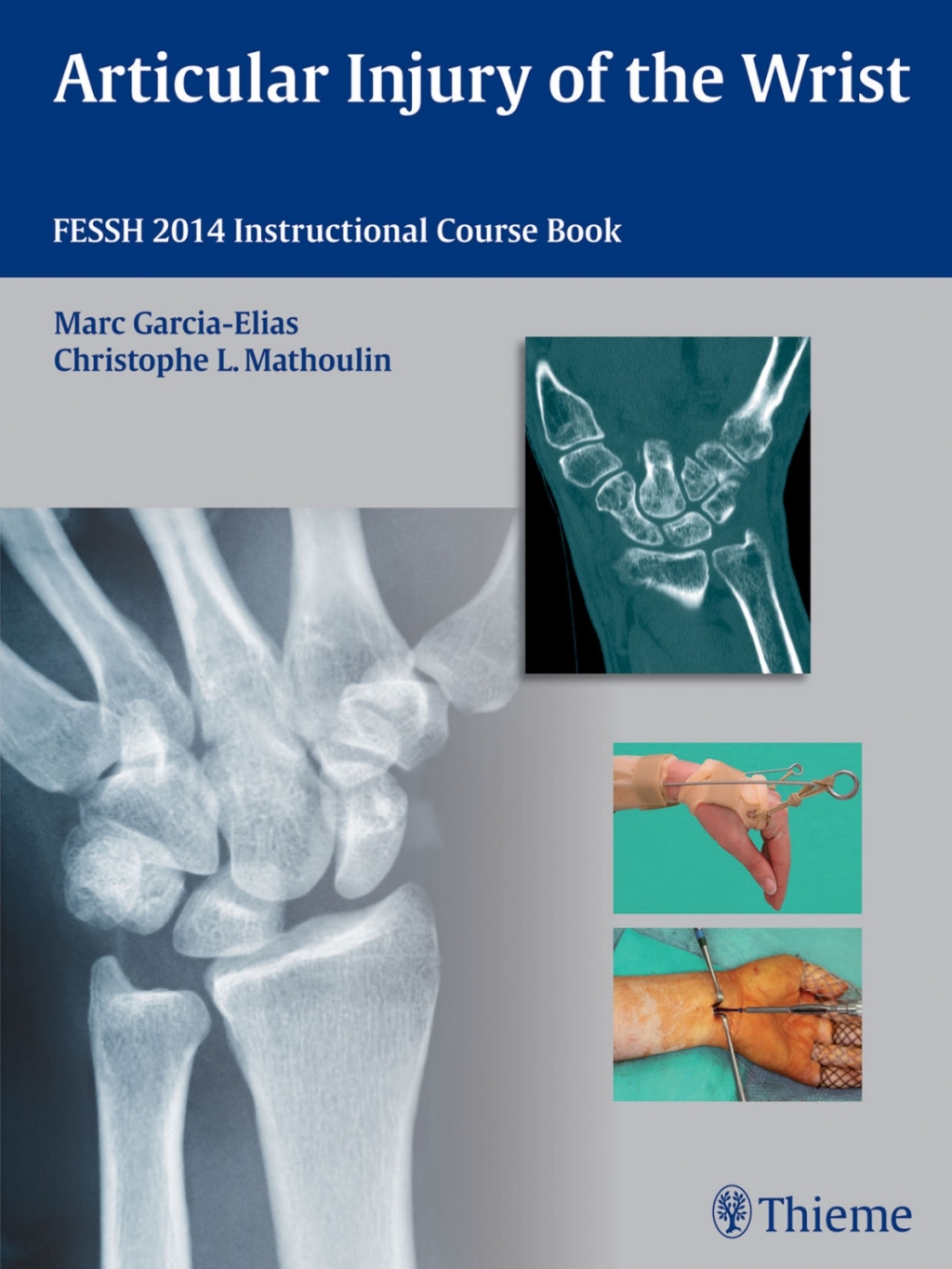 Articular Injury of the Wrist FESSH 2014 Instructional Course Book 1st Edition â€“ PDF/EPUB Version Downloadable