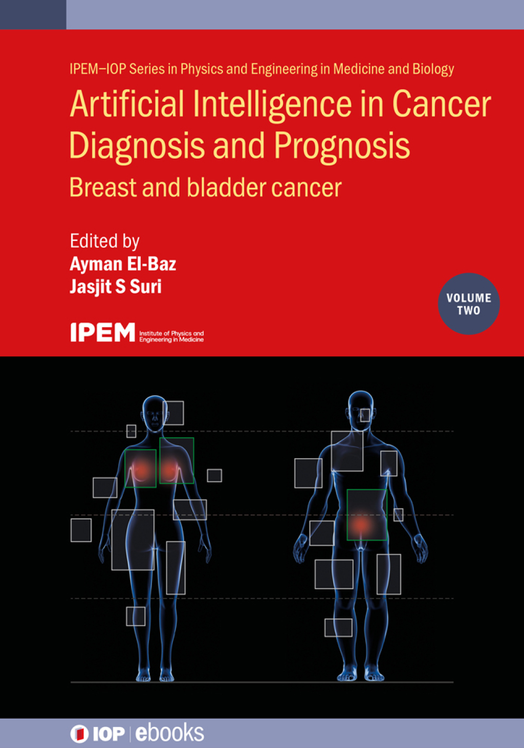 Artificial Intelligence in Cancer Diagnosis and Prognosis, Volume 2 ...