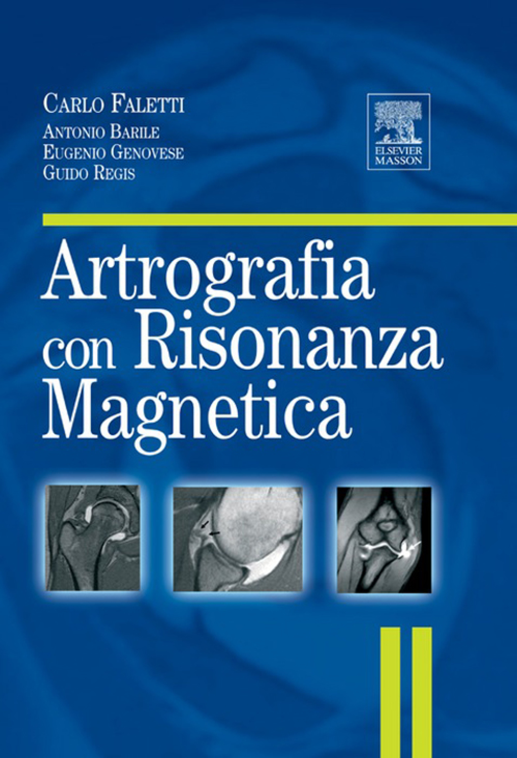 ARTROGRAFIA CON RISONANZA MAGNETICA  â€“ PDF/EPUB Version Downloadable