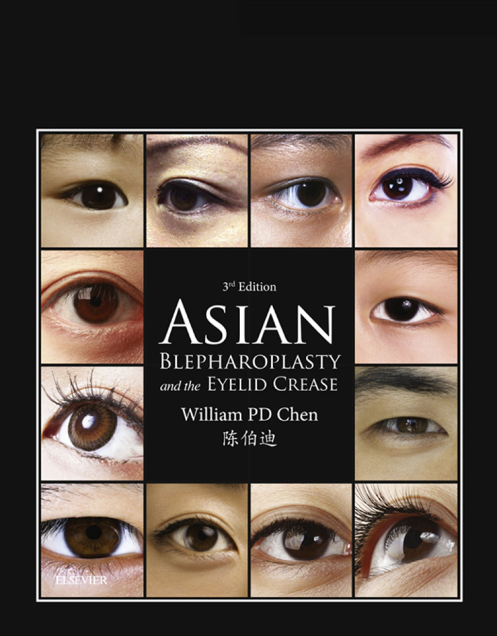 Asian Blepharoplasty and the Eyelid Crease 3rd Edition â€“ PDF/EPUB Version Downloadable