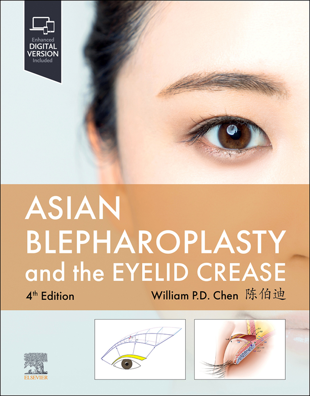 Asian Blepharoplasty and the Eyelid Crease 4th Edition â€“ PDF/EPUB Version Downloadable