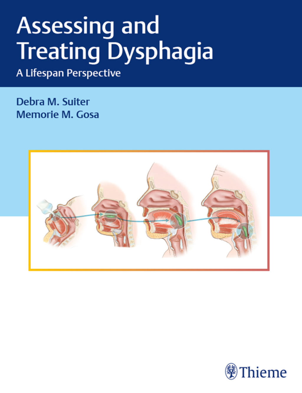 Assessing and Treating Dysphagia A Lifespan Perspective 1st Edition â ...