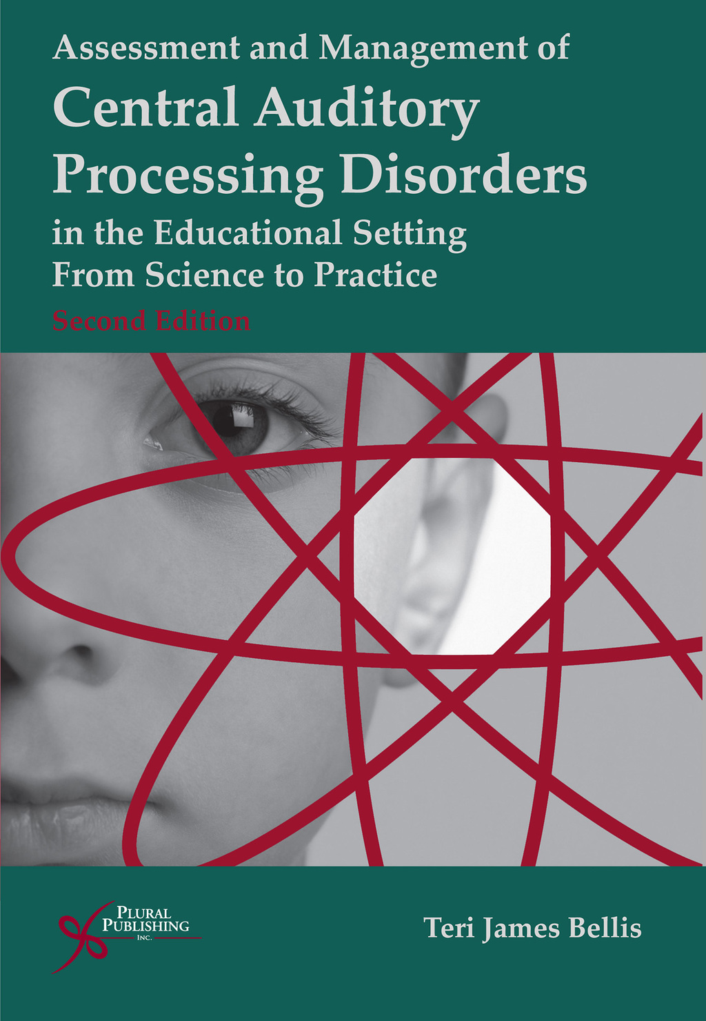 Assessment and Management of Central Auditory Processing Disorders in ...
