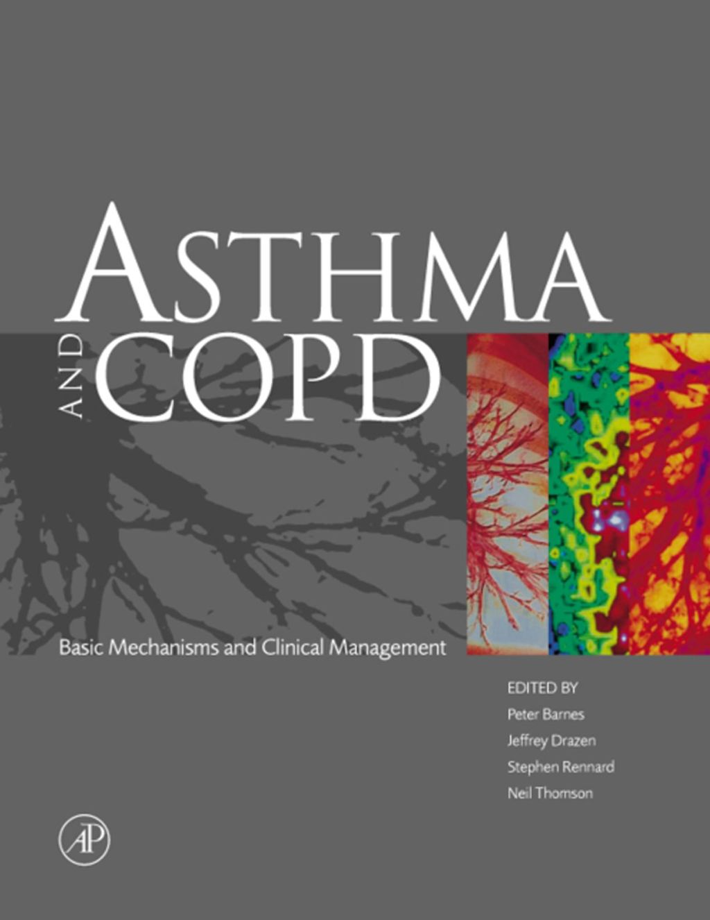 Asthma and COPD: Basic Mechanisms and Clinical Management â€“ PDF/EPUB Version Downloadable
