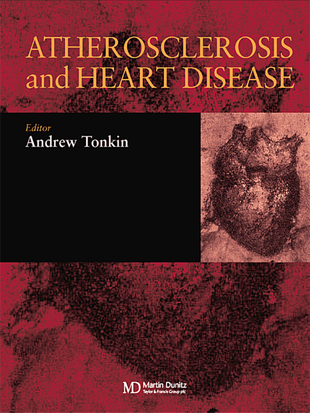 Atherosclerosis and Heart Disease 1st Edition â€“ PDF/EPUB Version Downloadable