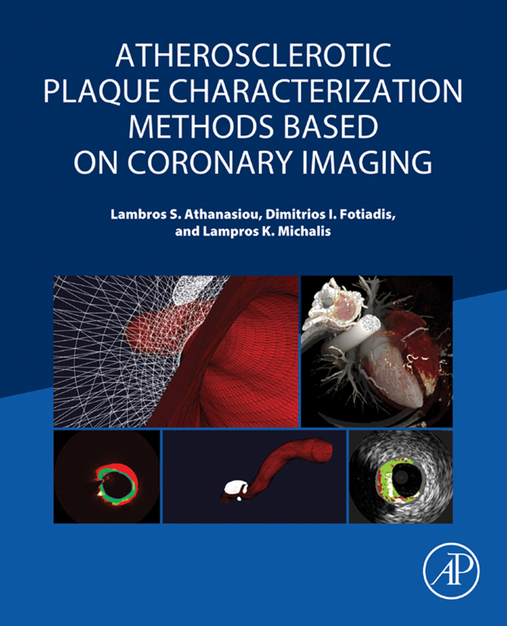 Atherosclerotic Plaque Characterization Methods Based on Coronary ...