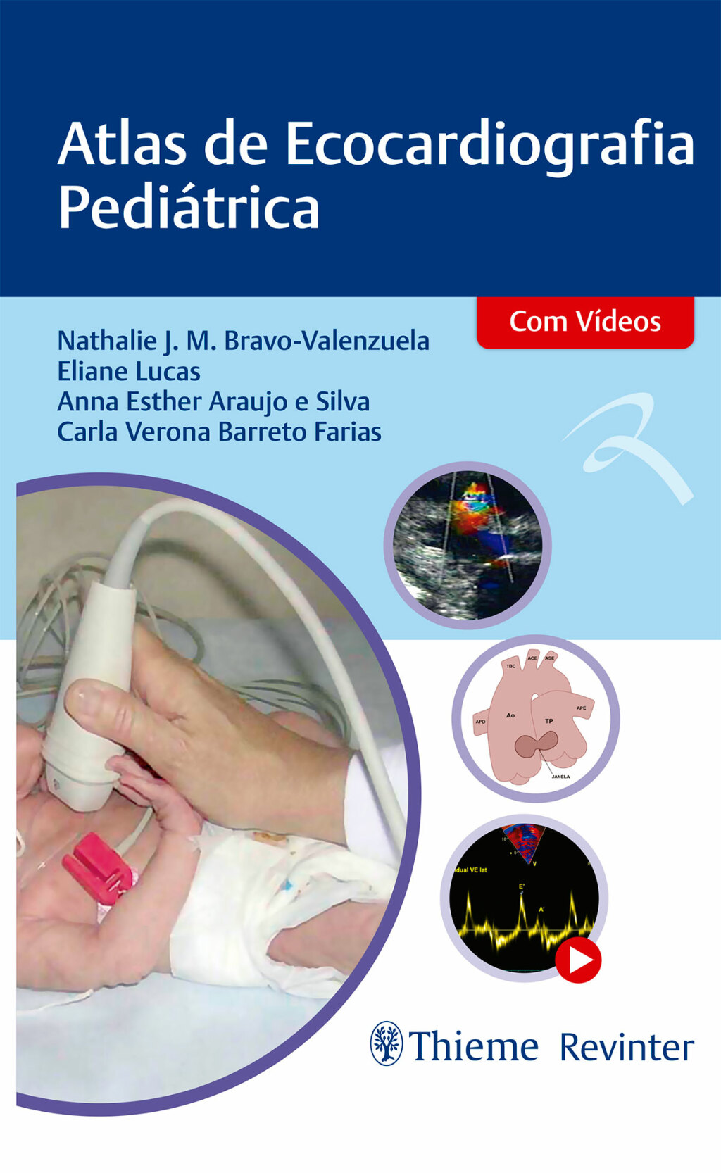 Atlas de Ecocardiografia PediÃ¡trica 1st Edition â€“ PDF/EPUB Version Downloadable
