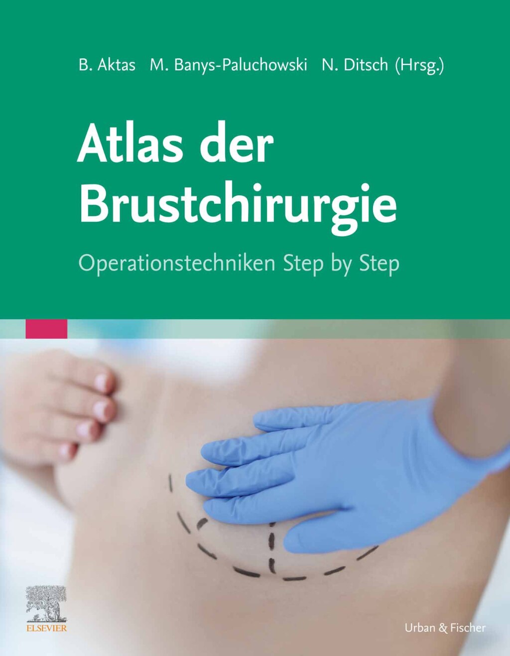 Atlas der Brustchirurgie Operationstechniken Step by Step 1st Edition â€“ PDF/EPUB Version Downloadable