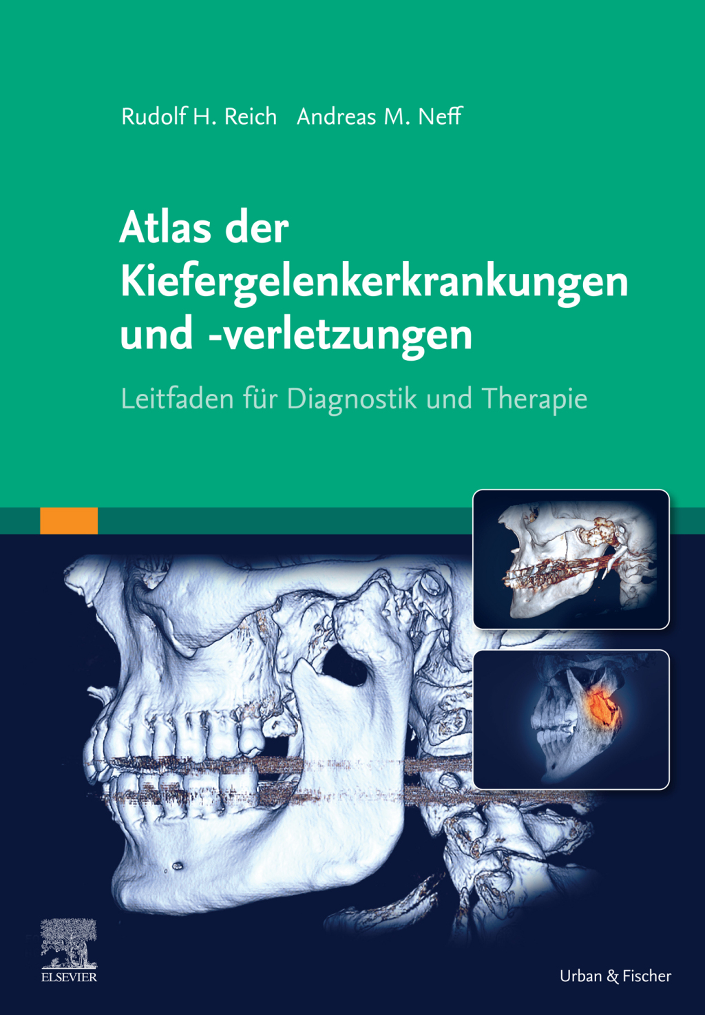 Atlas der Kiefergelenkerkrankungen und -verletzungen Leitfaden zur Diagnostik und Therapie â€“ PDF/EPUB Version Downloadable