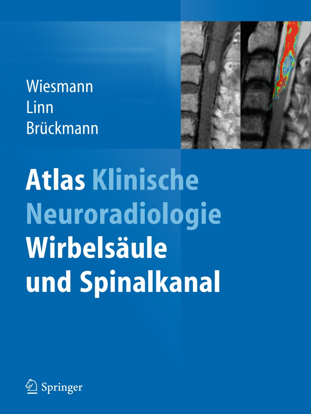 Atlas Klinische Neuroradiologie WirbelsÃ¤ule und Spinalkanal â€“ PDF/EPUB Version Downloadable