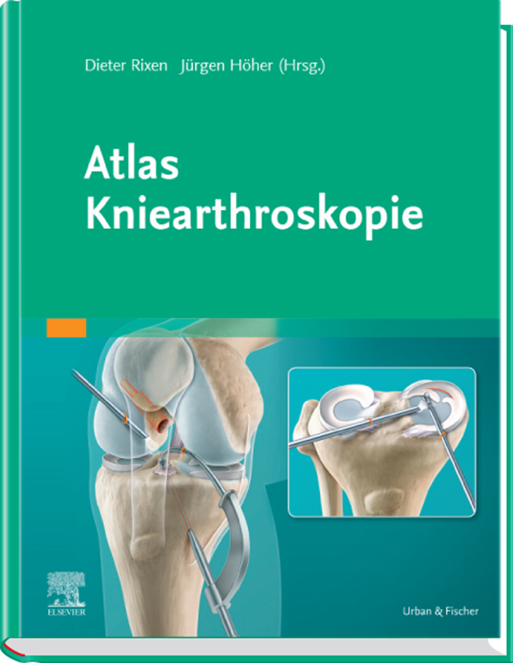 Atlas Kniearthroskopie 1st Edition â€“ PDF/EPUB Version Downloadable