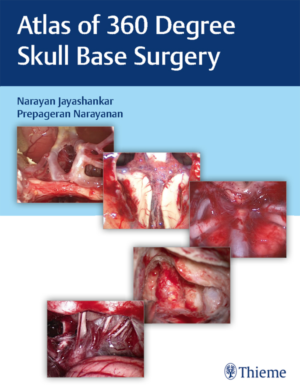 Atlas of 360 Degree Skull Base Surgery 1st Edition â€“ PDF/EPUB Version Downloadable