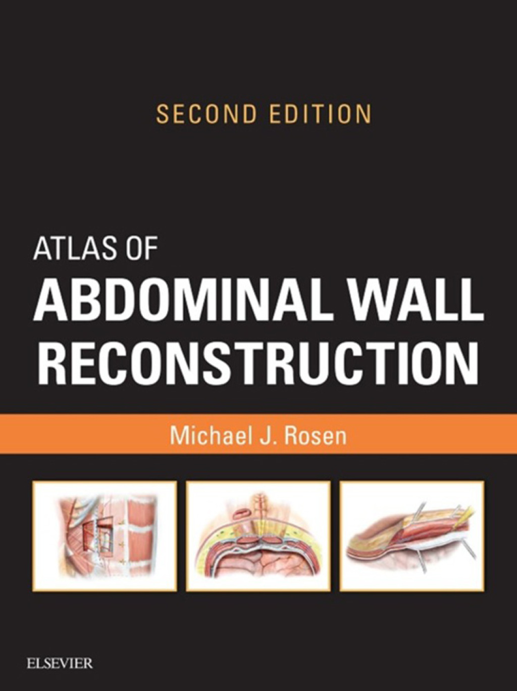 Atlas of Abdominal Wall Reconstruction 2nd Edition â€“ PDF/EPUB Version Downloadable