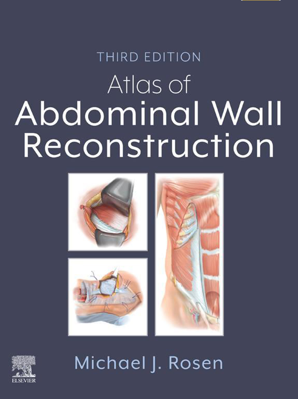 Atlas of Abdominal Wall Reconstruction 3rd Edition â€“ PDF/EPUB Version Downloadable
