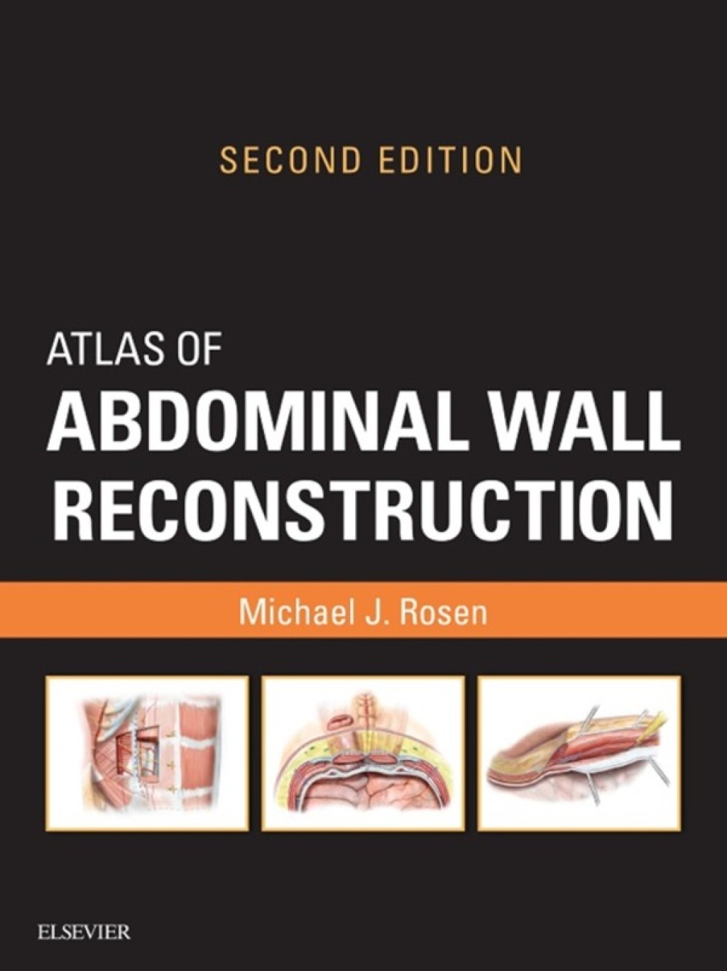 Atlas of Abdominal Wall Reconstruction E-Book Atlas of Abdominal Wall Reconstruction E-Book 2nd Edition â€“ PDF/EPUB Version Downloadable