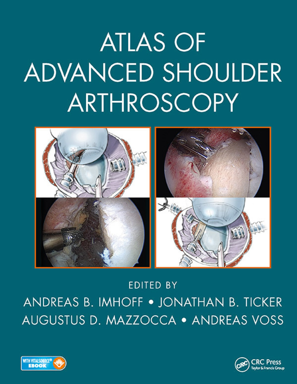Atlas of Advanced Shoulder Arthroscopy 1st Edition â€“ PDF/EPUB Version Downloadable