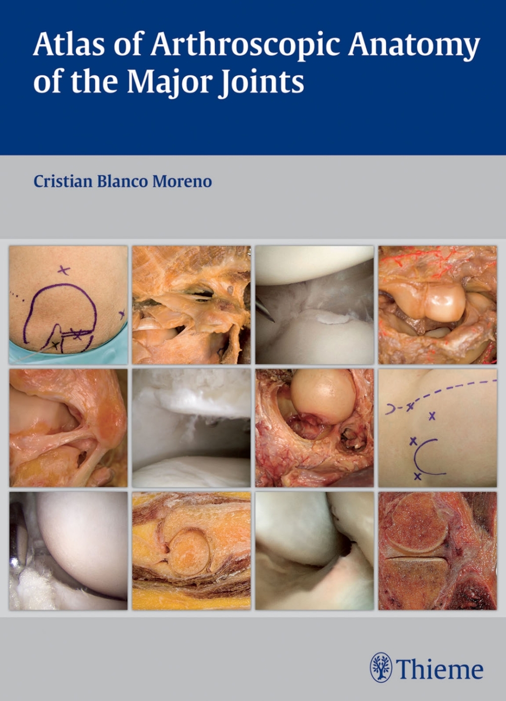 Atlas of Arthroscopic Anatomy of the Major Joints 1st Edition â€“ PDF/EPUB Version Downloadable