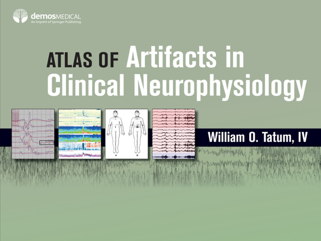 Atlas of Artifacts in Clinical Neurophysiology 1st Edition â€“ PDF/EPUB Version Downloadable