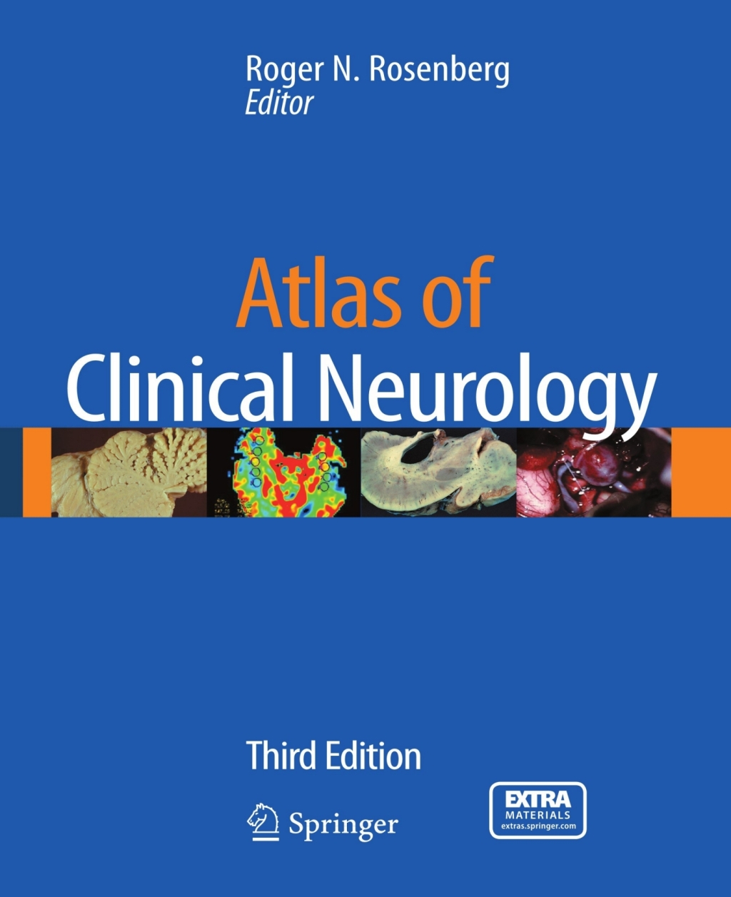 Atlas of Clinical Neurology 3rd Edition â€“ PDF/EPUB Version Downloadable