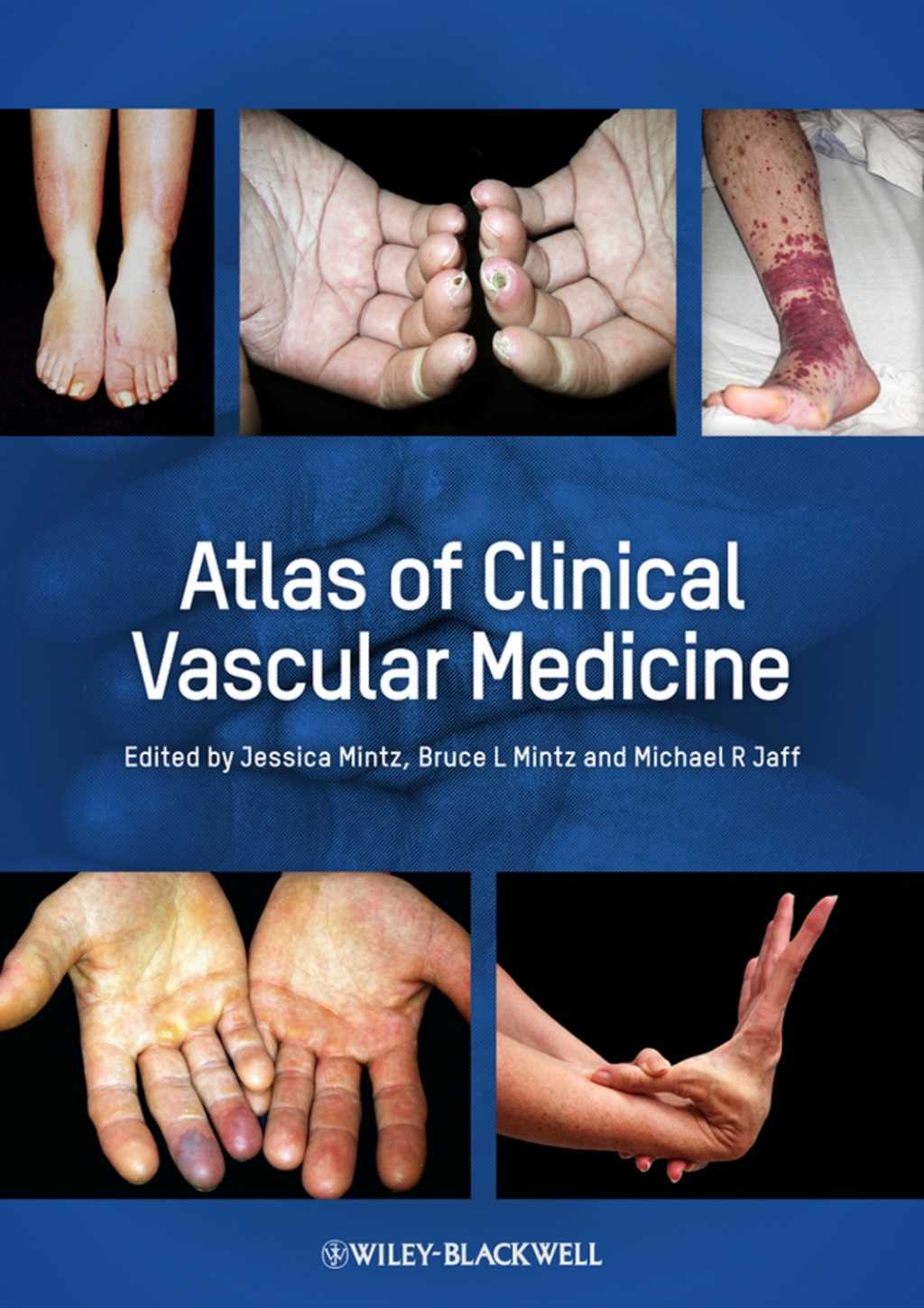 Atlas of Clinical Vascular Medicine 1st Edition â€“ PDF/EPUB Version Downloadable