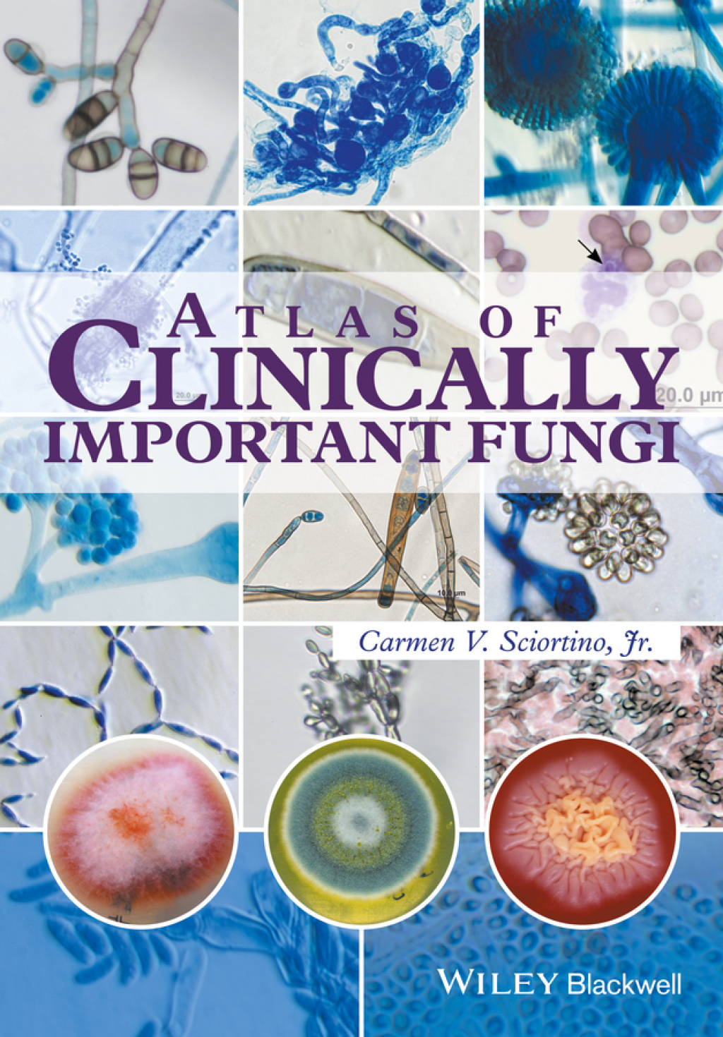 Atlas of Clinically Important Fungi 1st Edition â€“ PDF/EPUB Version Downloadable