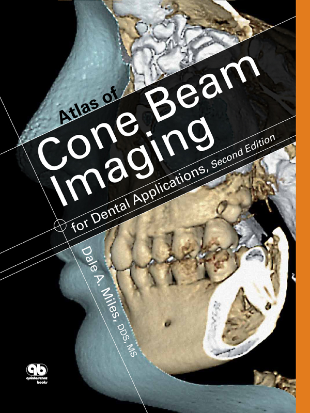 Atlas of Cone Beam Imaging for Dental Applications, Second Edition 2nd Edition - (PDF/EPUB Version)