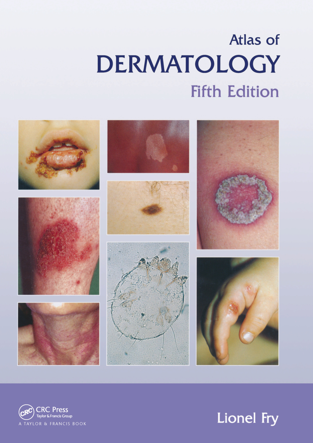 Atlas of Dermatology, Fifth Edition 5th Edition â€“ PDF/EPUB Version Downloadable
