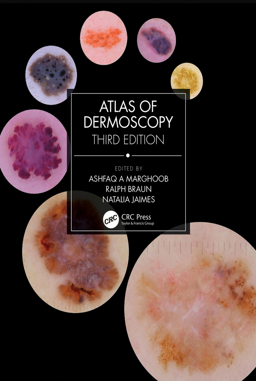 Atlas of Dermoscopy Third Edition 3rd Edition â€“ PDF/EPUB Version Downloadable