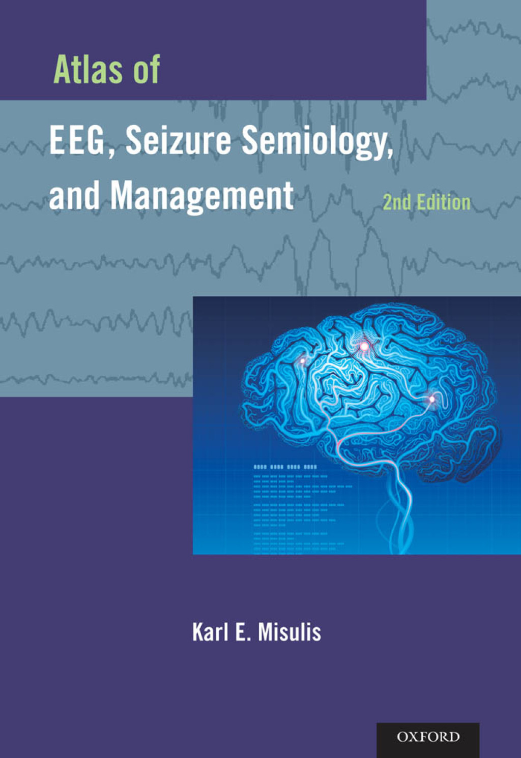Atlas of EEG, Seizure Semiology, and Management 2nd Edition â€“ PDF/EPUB Version Downloadable