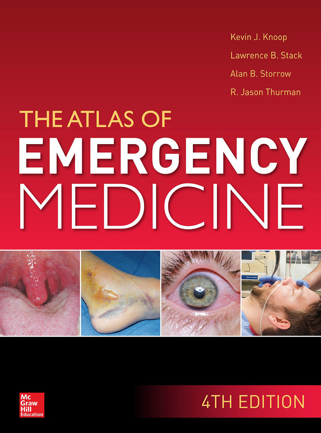 Atlas of Emergency Medicine, 4th Edition 4th Edition â€“ PDF/EPUB Version Downloadable