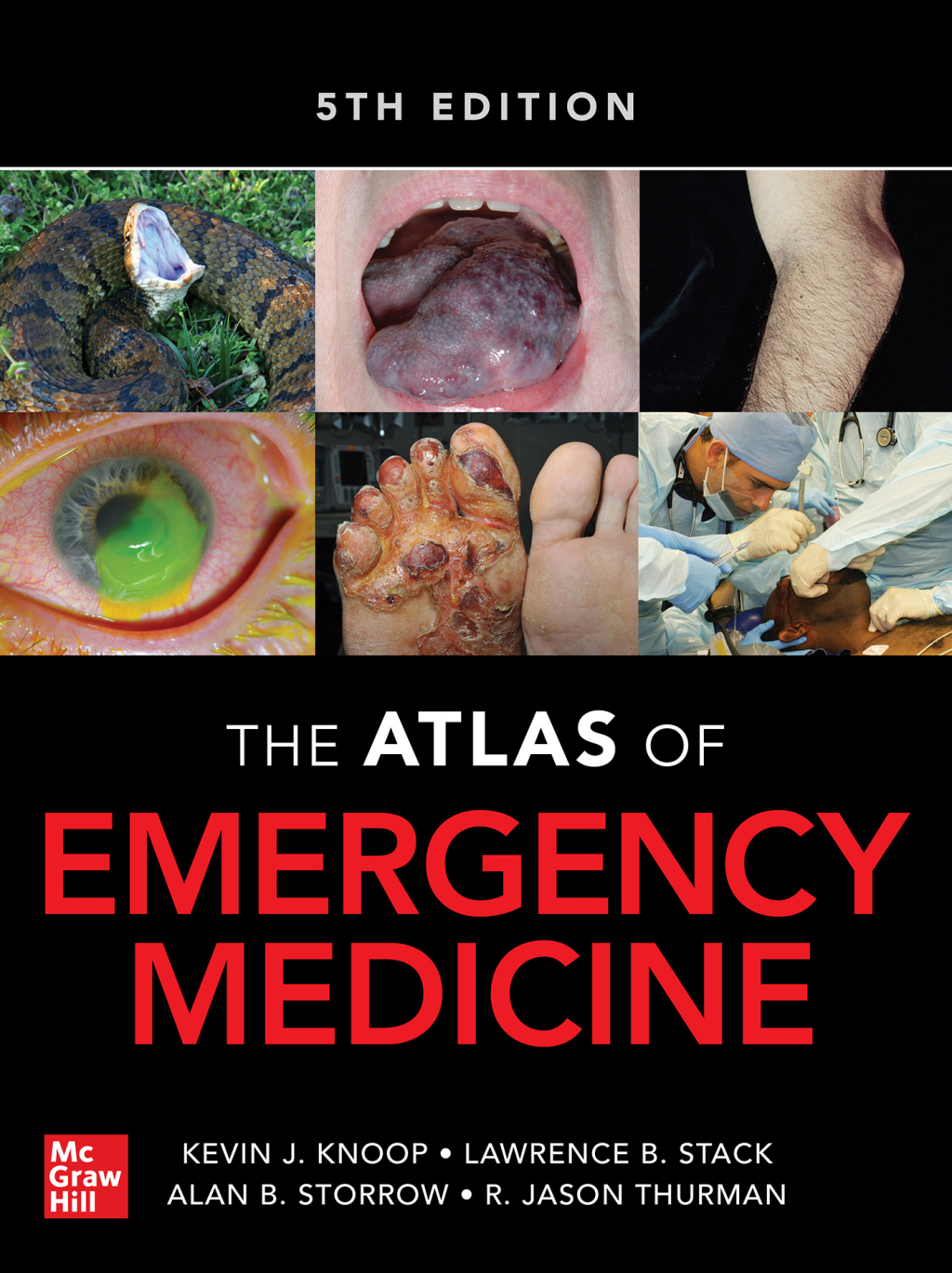 Atlas of Emergency Medicine 5th Edition â€“ PDF/EPUB Version Downloadable