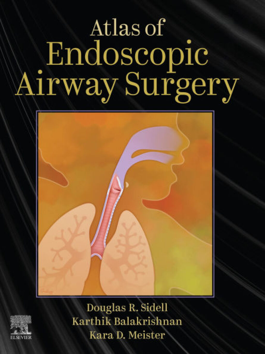 Atlas of Endoscopic Airway Surgery – PDF/EPUB Version Downloadable Atlas of Endoscopic Airway Surgery – PDF/EPUB Version Downloadable - Image 1