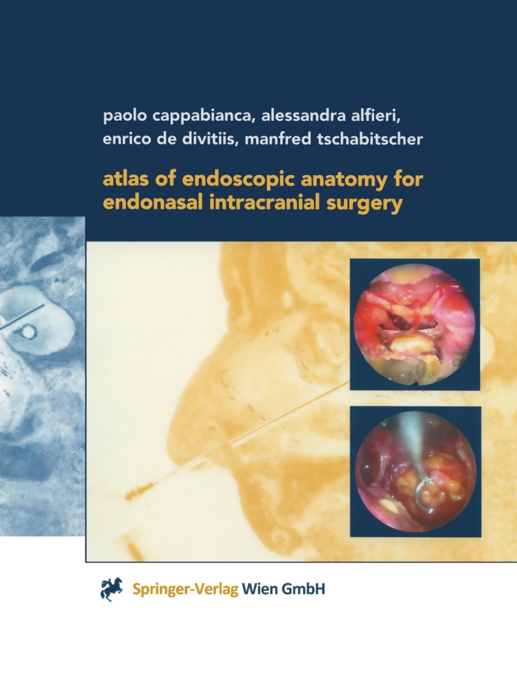 Atlas of Endoscopic Anatomy for Endonasal Intracranial Surgery â€“ PDF ...