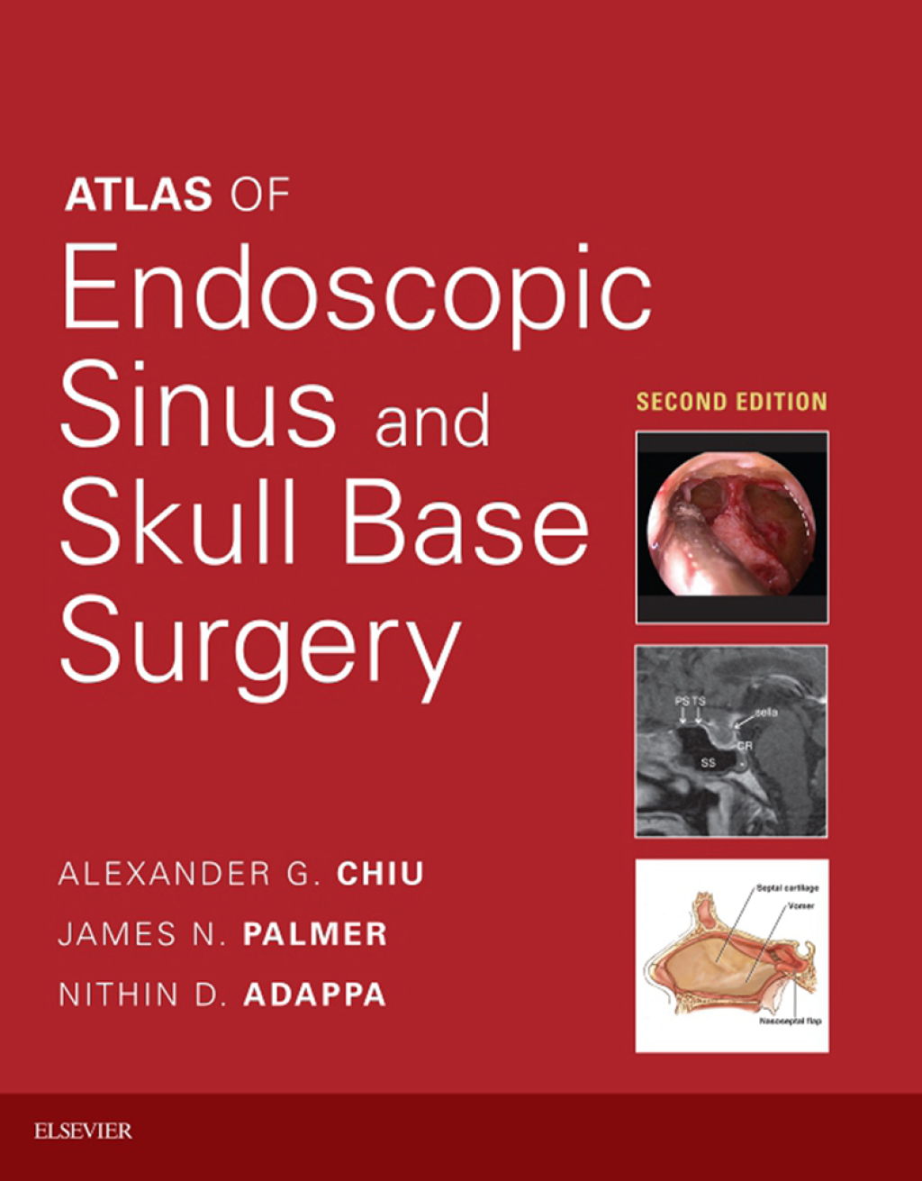 Atlas of Endoscopic Sinus and Skull Base Surgery 2nd Edition â€“ PDF/EPUB Version Downloadable