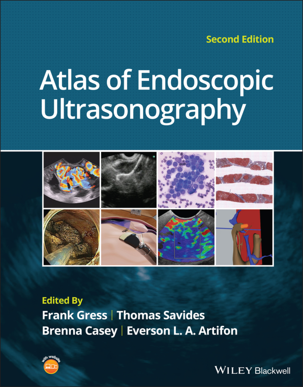 Atlas of Endoscopic Ultrasonography 2nd Edition â€“ PDF/EPUB Version Downloadable