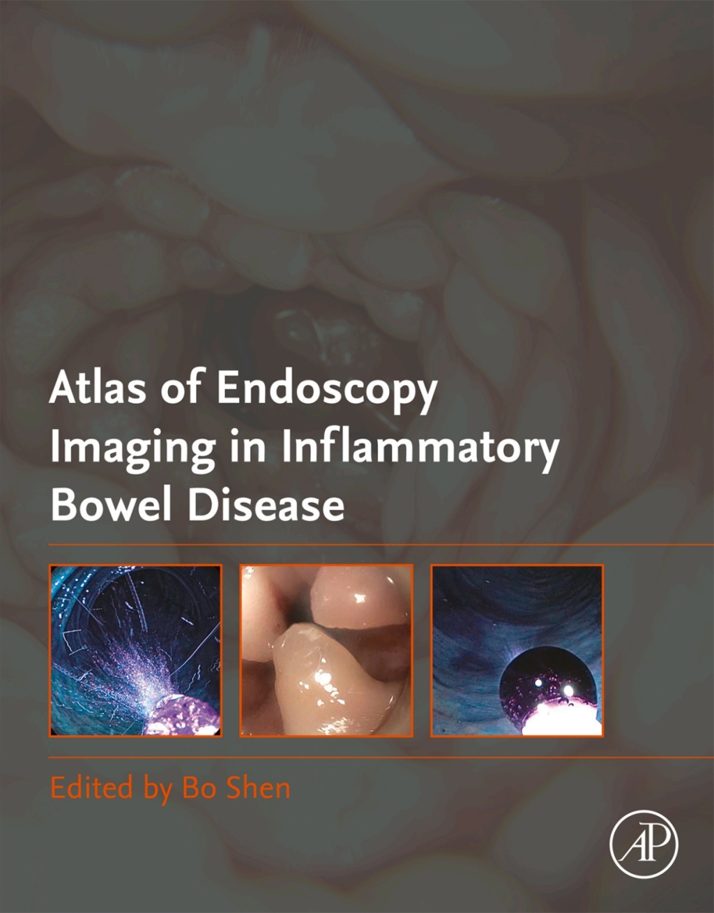 Atlas of Endoscopy Imaging in Inflammatory Bowel Disease 1st Edition â ...