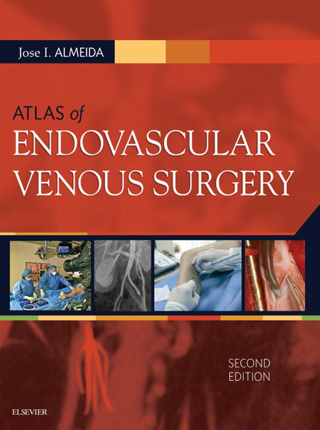 Atlas of Endovascular Venous Surgery 2nd Edition â€“ PDF/EPUB Version Downloadable