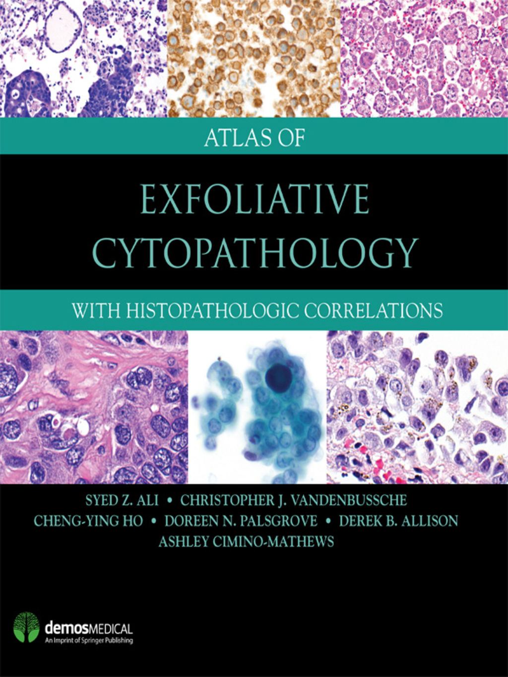Atlas of Exfoliative Cytopathology With Histopathologic Correlations 1st Edition â€“ PDF/EPUB Version Downloadable