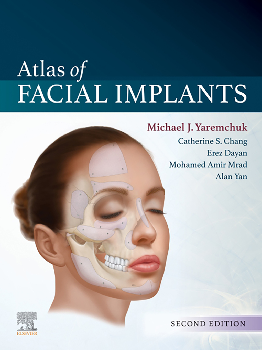 Atlas of Facial Implants 2nd Edition â€“ PDF/EPUB Version Downloadable