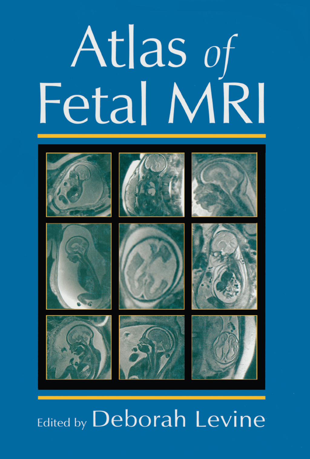 Atlas of Fetal MRI 1st Edition â€“ PDF/EPUB Version Downloadable