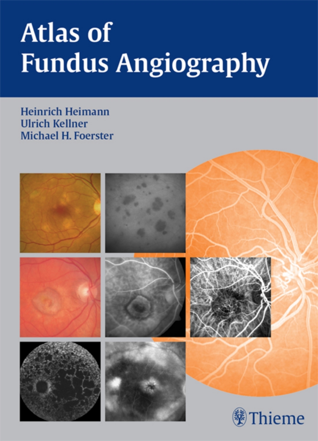 Atlas of Fundus Angiography 1st Edition â€“ PDF/EPUB Version Downloadable