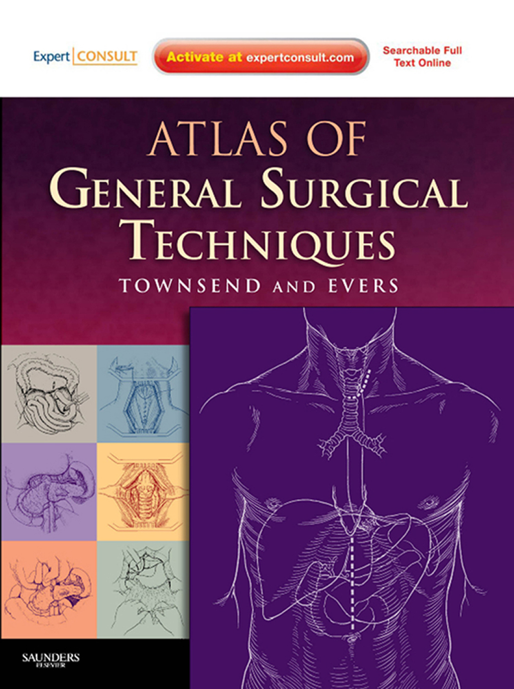 Atlas of General Surgical Techniques - Electronic 1st Edition â€“ PDF/EPUB Version Downloadable