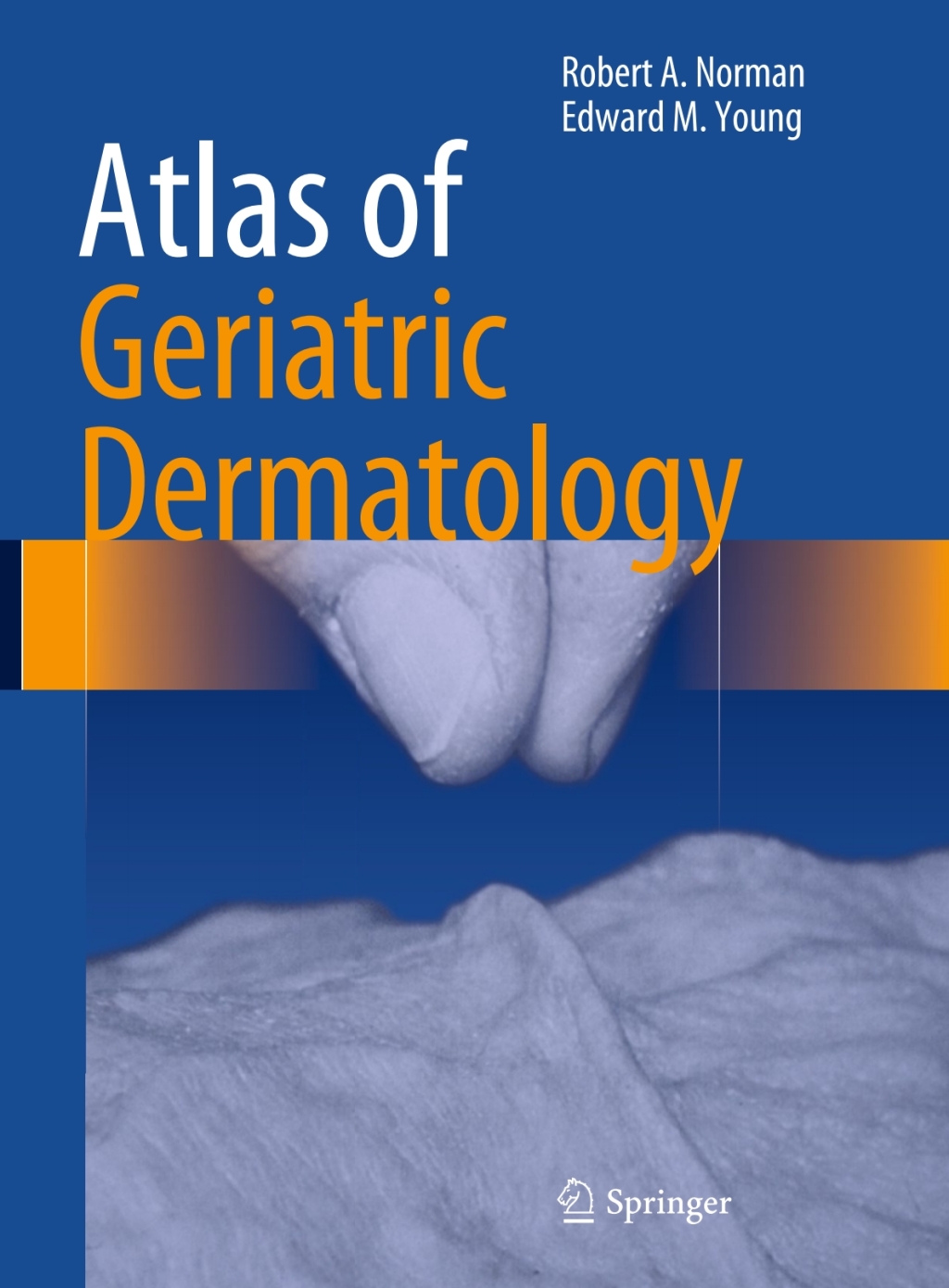 Atlas of Geriatric Dermatology â€“ PDF/EPUB Version Downloadable