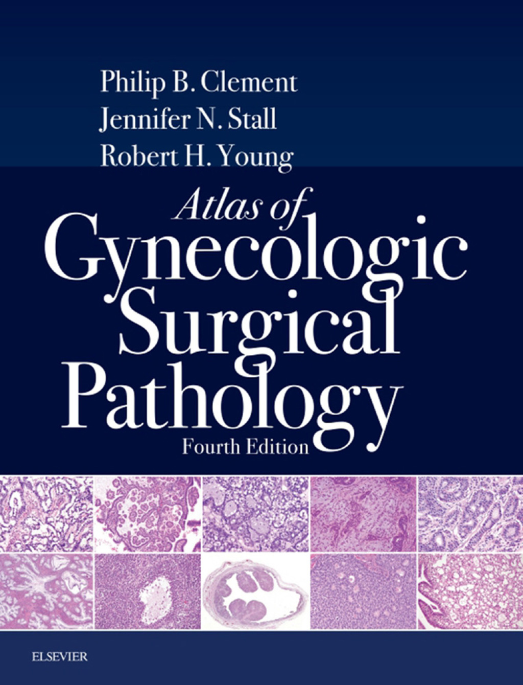 Atlas of Gynecologic Surgical Pathology E-Book 4th Edition â€“ PDF/EPUB Version Downloadable