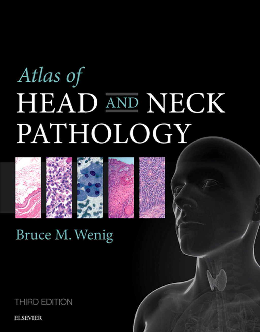 Atlas of Head and Neck Pathology 3rd Edition â€“ PDF/EPUB Version Downloadable