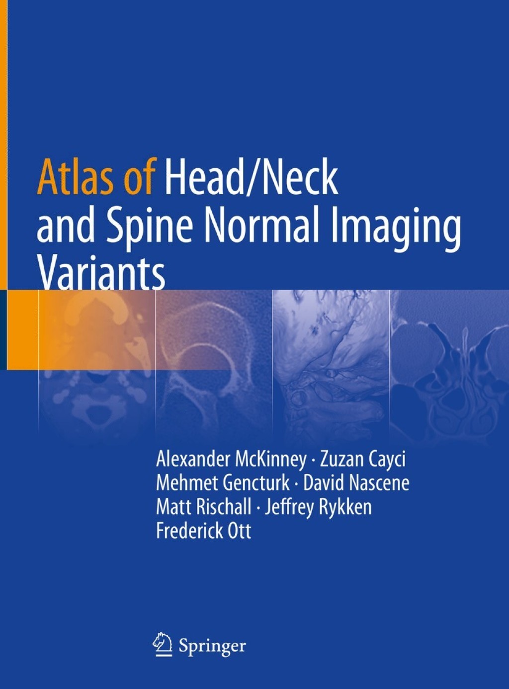 Atlas of Head/Neck and Spine Normal Imaging Variants â€“ PDF/EPUB Version Downloadable